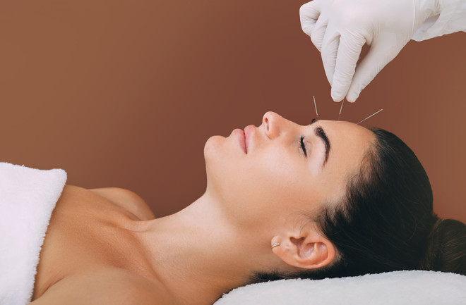 A person receiving accupuncture treatment with thin needles inserted into various points on the body