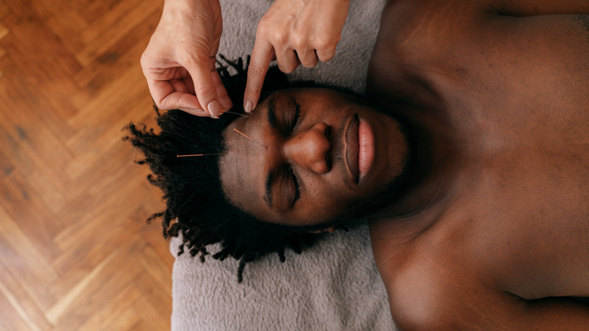 Discover More About Acupuncture Now to Get Effective Stress and Pain Relief, Fast!